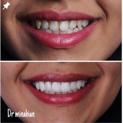 دندانپزشک مینابیان بندرعباس