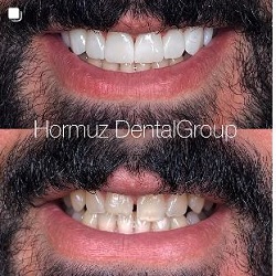 دندانپزشکی هرمز بندرعباس