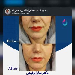 اینستاگرام دکتر سارا رفیعی متخصص پوست بندرعباس