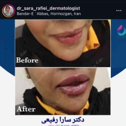 بهترین دکتر تزریق ژل بندرعباس