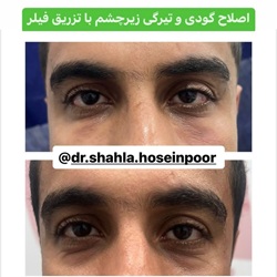 بهترین دکتر پوست_شهلا حسین پور