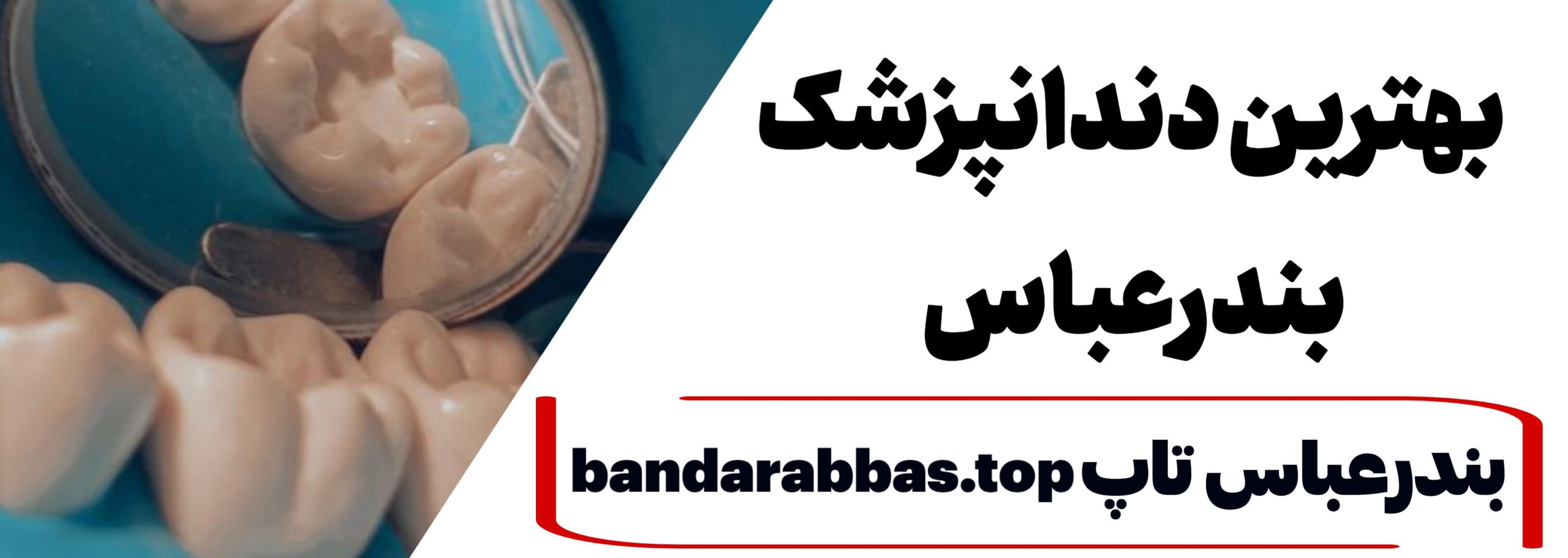 بهترین دندانپزشک بندرعباس