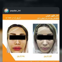 اینستاگرام دکتر ظهیر عباس متخصص پوست بندرعباس