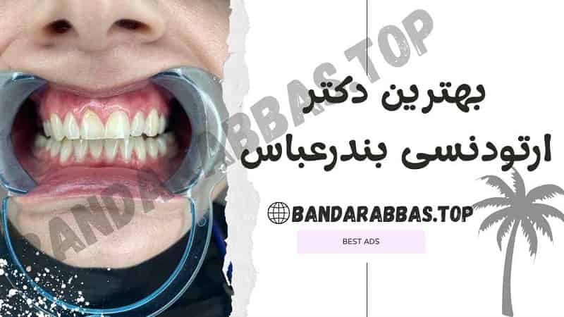بهترین دکتر ارتودنسی بندرعباس