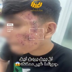 دکتر پوست_شهلا حسین پور