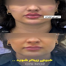 کلینیک تزریق ژل یاس بندرعباس
