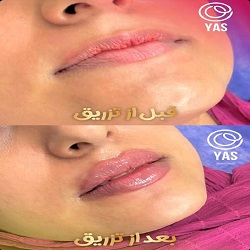 بهترین کلینیک تزریق ژل بندرعباس