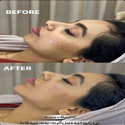 اینستاگرام کلینیک تزریق ژل یاس بندرعباس