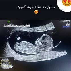 دکتر کاویان متخصص زنان در بندرعباس