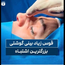 اینستاگرام دکتر سیف اله همت جراخ بینی بندرعباس