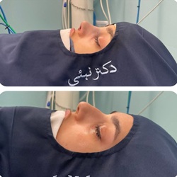 هنگامه نبئی | جراح بینی بندرعباس