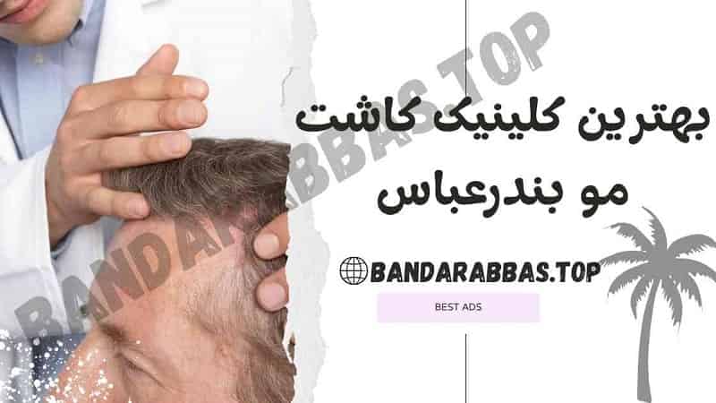 بهترین کلینیک کاشت مو بندرعباس