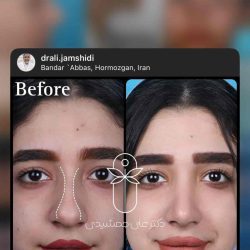 دکتر علی جمشیدی | بهترین جراح بینی بندرعباس