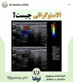 مرکز سی تی اسکن توانا بندرعباس