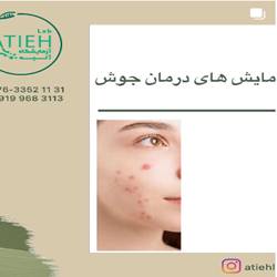 ازمایشگاه اتیه بندرعباس