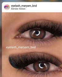 کاشت مژه مریم بندرعباس