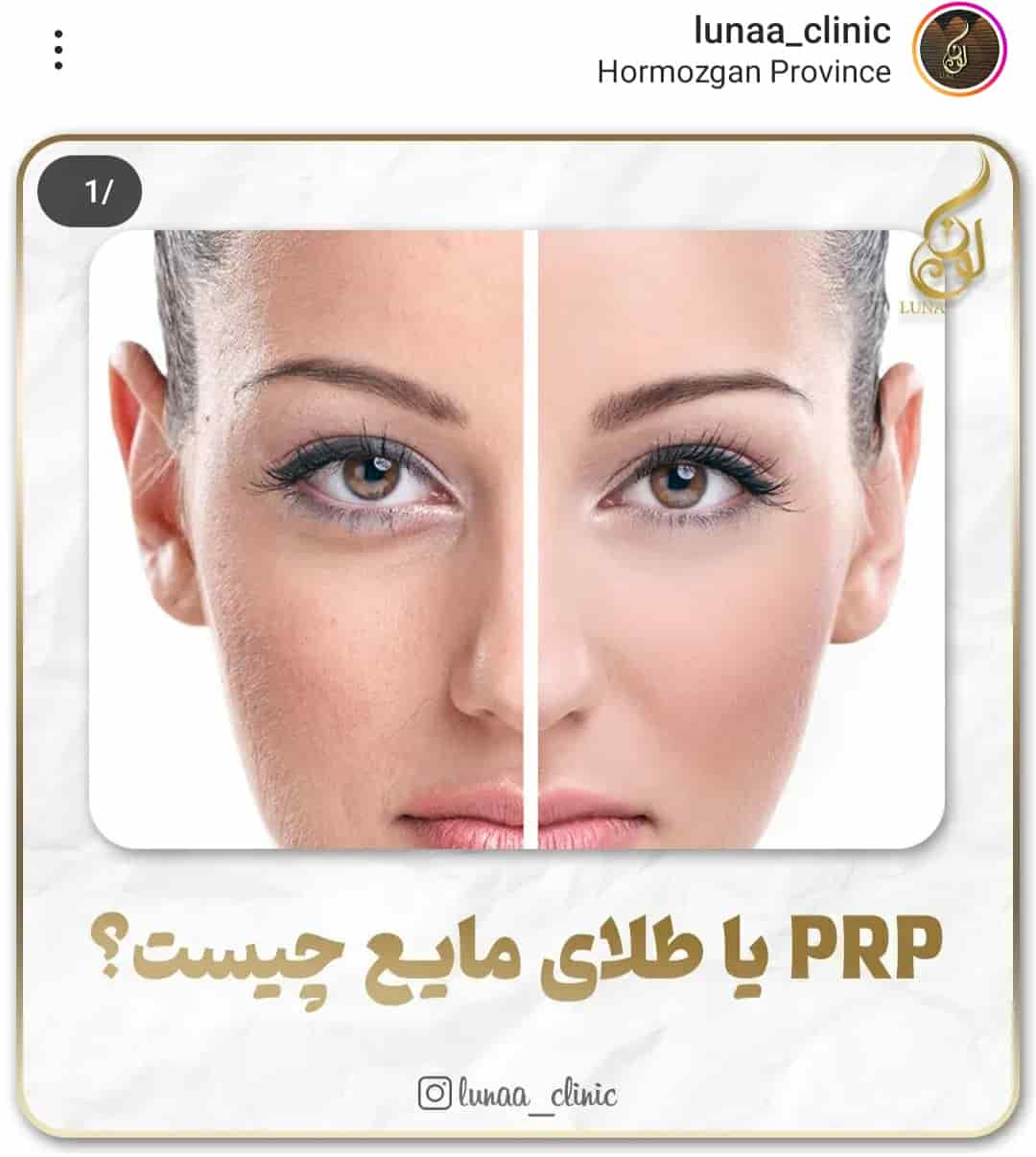 کلینیک پاکسازی پوست لونا بندرعباس