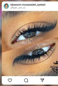 اینستاگرام کاشت مژه تبسم بندرعباس