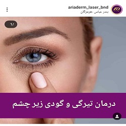 پاکسازی و فیشال پوست آریادرم بندرعباس