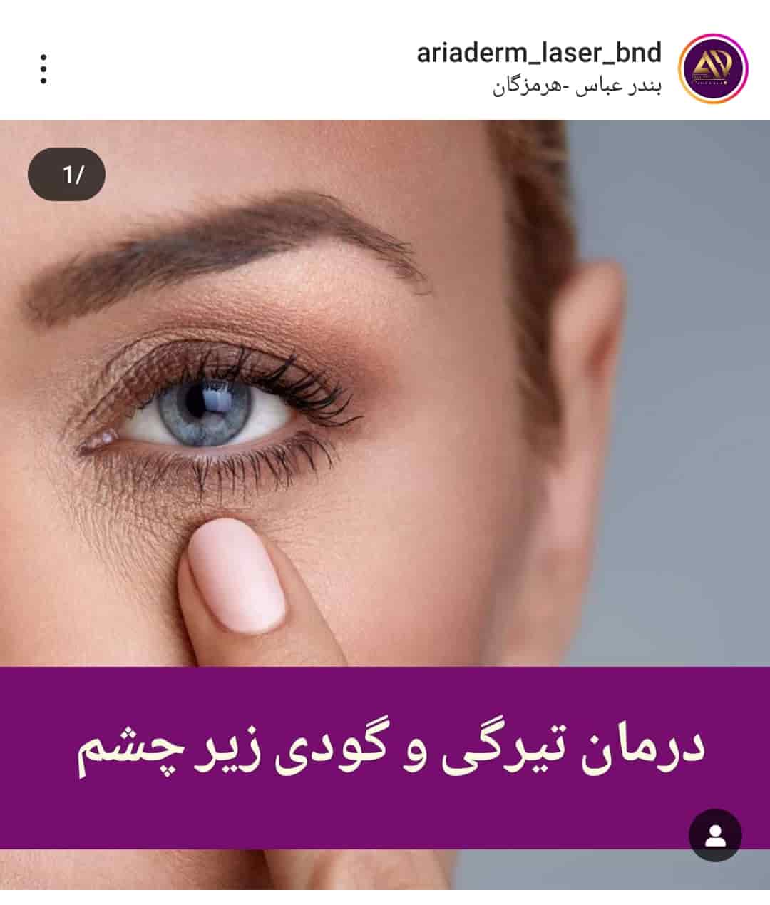 مرکز تخصصی پاکسازی پوست آریا درم