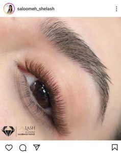 کاشت مژه سالومه بندرعباس