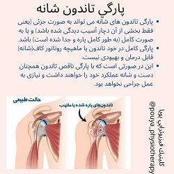 مرکز پویا بهترین فیزیوتراپی بندرعباس