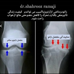 اینستاگرام دکتر شهروز رمجی طب سنتی بندرعباس