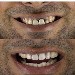 دکتر آرش جنگجو | بهترین متخصص ایمپلنت بندرعباس