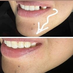 اینستاگرام دکتر سمانه عباسی | دکتر ایمپلنت بندرعباس