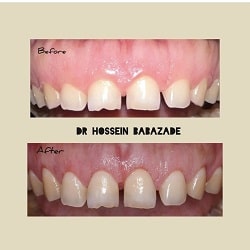 بهترین متخصص ایمپلنت بندرعباس