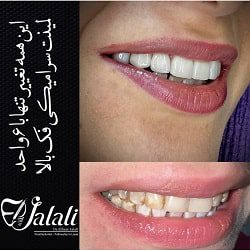 الهام جلالی دکتر ایمپلنت بندرعباس