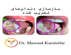دکتر مسعود کریمی فر | بهترین دندانپزشک بندرعباس