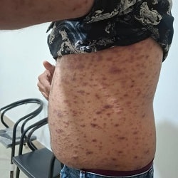 دکتر مهدی فراشاهی نژاد متخصص عفونی