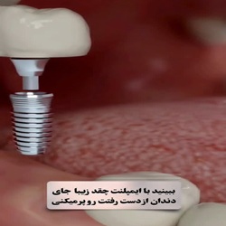 بهترین دندان پزشک بندرعباس_دکتر دارشی