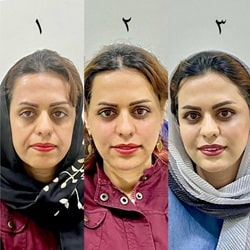 پاکسازی پوست هدا بندرعباس