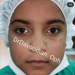 متخصص بیماری های چشک_دکتر داودیان