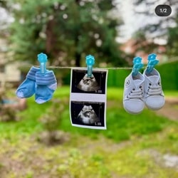 سونوگرافی دکتر محمدرضا مهری