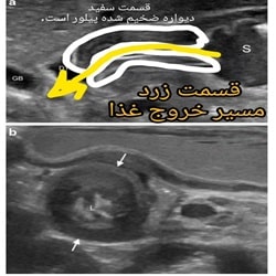 سونوگرافی دکتر مهری_بندرعباس