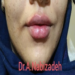 دکتر نبی زاده _بندرعباس