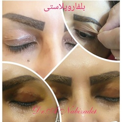 بهترین جراح پلاستیک بندرعباس_نبی زاده