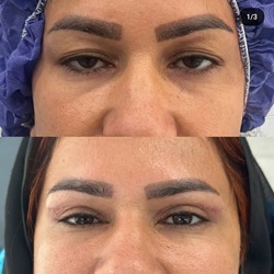 نبی زاده _متخصص زیبایی