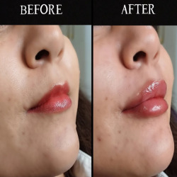  کلینیک لاغری آرا بندرعباس | بهترین کلینیک لاغری بندرعباس