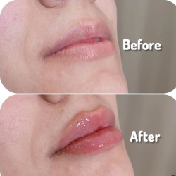 بهترین کلینیک لاغری بندرعباس