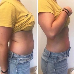 کلینیک های لاغری بندرعباس