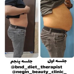  کلینیک لاغری نگین بندرعباس