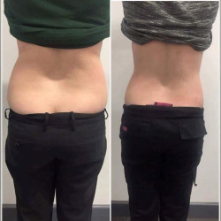 اینستاگرام کلینیک لاغری پادرا | بهترین کلینیک لاغری بندرعباس