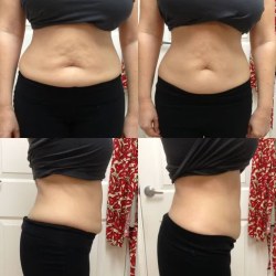 کلینیک لاغری ریوند دایت | بهترین کلینیک لاغری بندرعباس