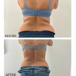 بهترین کلینیک لاغری بندرعباس