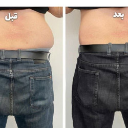 کلینیک لاغری پادرا | بهترین کلینیک لاغری بندرعباس