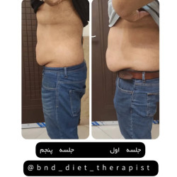 بهترین کلینیک لاغری بندرعباس